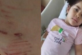 Sokakta Oynayan 5 Yaşındaki Kıza Sokak Köpekleri Saldırdı! Anne-Baba İsyanda