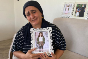 parmak-izi-gibi-essiz-dis-isi-gizemi-nasil-cozuyor-zmjr.jpg