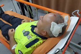 Sen misin Torunuma Ceza Kesen Diyerek Sandalyeyi Polisin Kafasına Geçirdi!