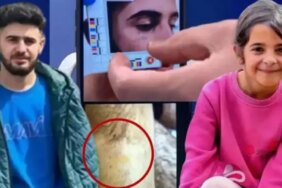 Enes Güran'ın Kolundaki Isırık ve Gözündeki Morluk Görüntüleri Davanın Seyrini Değiştirecek mi?