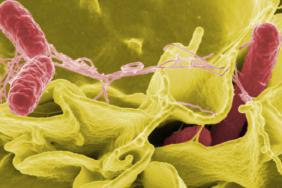 kumpirden-olum-sonrasi-salmonella-bakterisi-uyarisi-zd9e.jpg