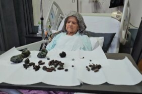 Yaşlı Kadının Mide Ve Bağırsaklarından Çıkanlar Görenleri Şok Etti