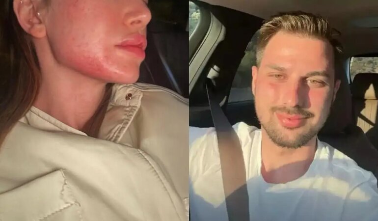 Danla Biliç’in Darp Edildiği Görüntüler Ortaya Çıktı! Danla Biliç’in Eski Sevgilisi Berk Çetin Kimdir?