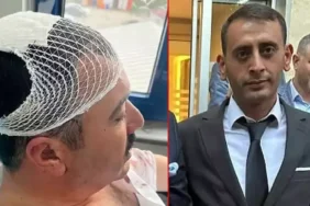 YRP'li İl Başkan Yardımcısı, Belediye Başkan Yardımcısı'nı şekerlikle başına vurarak yaraladı