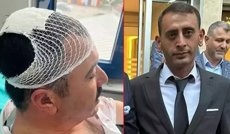 YRP’li İl Başkan Yardımcısı, Belediye Başkan Yardımcısı’nı şekerlikle başına vurarak yaraladı
