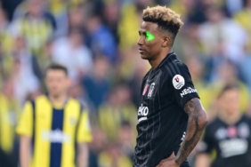 gedson-fernandesin-yuzune-lazer-tutan-taraftar-gozaltina-alindi-5xcj.jpg