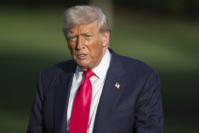 bacak-ve-ayaklarindaki-siskinlik-dikkat-cekmisti-trumpin-hastaligina-teshis-konuldu-ybdy.jpg