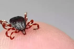 Sivas'ta 1 çocuk annesi keneden öldü