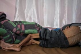 Gazze'de son 24 saatte 3'ü çocuk 9 kişi daha açlıktan öldü!