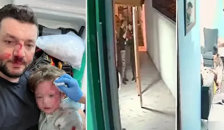 Baba Ve 14 Aylık Kızına Saldıran Zanlının 36 Yıla Kadar Hapsi İstendi