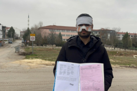 rehber-ogretmenin-yuzune-sicak-cay-firlattigi-fizik-ogretmeni-feci-sekilde-yandi-ma3a.jpg