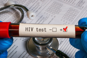 pasifik-ulkesinde-hiv-alarmi-ulusal-kriz-ilan-edildi-7rvu.jpg