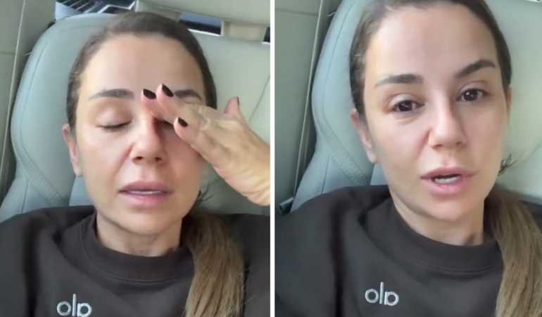 Merve Özbey sahnede merdivenden düştü: İşte son sağlık durumu